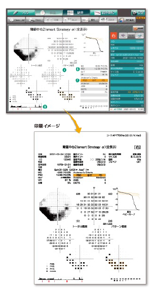 検査データイメージ