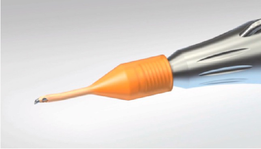 白内障の手術器械